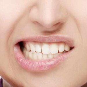 Mastigação errada pode causar