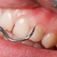 Quais os impactos das doenças periodontais (3)