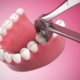 extraccao_dentaria_arrancar_dente_dentista_ss