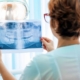 dentista-examinando-raio-x-perda-ossea