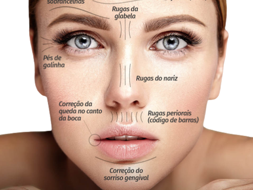 oque-mudar-harmonizacao-min-1-removebg-preview