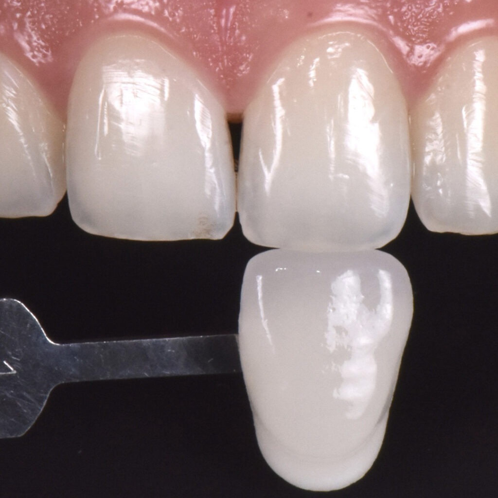 melhor creme dental para lentes de contato