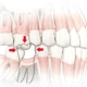 Ausência de dentes e suas consequências (3)