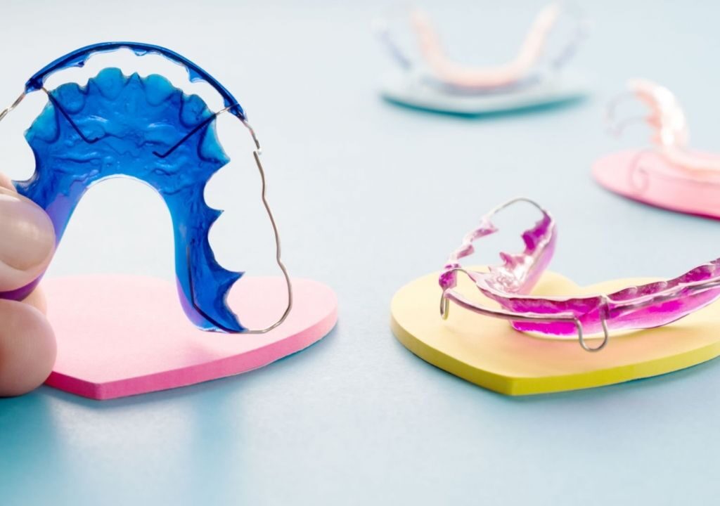 Contenção Ortodôntica: O Que Você Precisa Saber Após Tirar o Aparelho